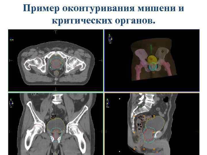 О. Ю. Аникеева, 2011 ННИИПК им. академика Е. Н. Мешалкина 