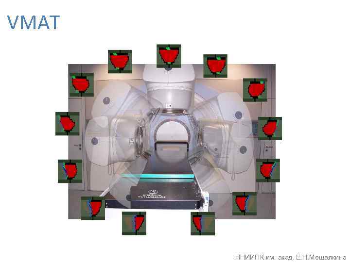  Лучевая терапия • верификация (портальный снимок) • дистанционная коррекция положения пациента • процедура