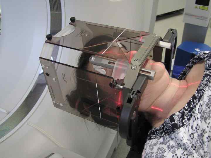 М. , 48 лет. Солитарный метастатический очаг головного мозга без первичного выявленного очага. Ноябрь,