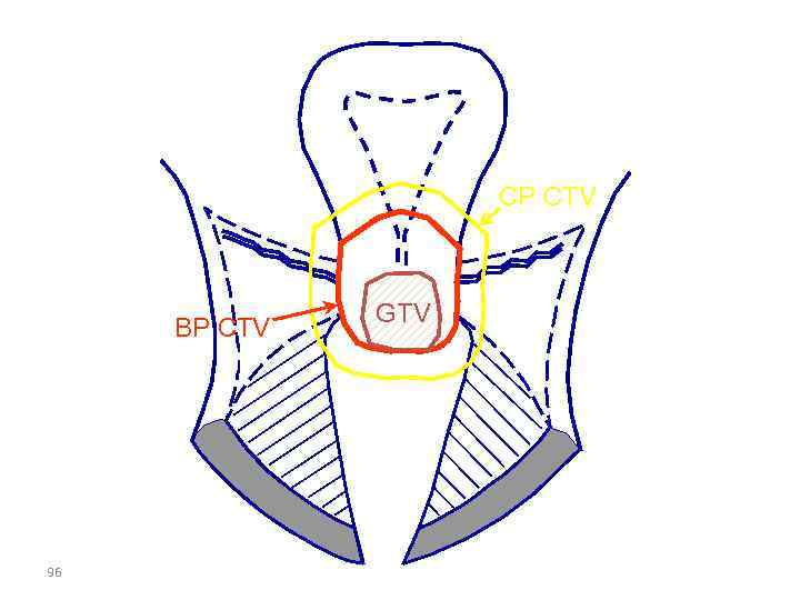  Aппликаторы Vaginal mould • Размер соответствует размеру культи влагалища и влагалищу • Близкий