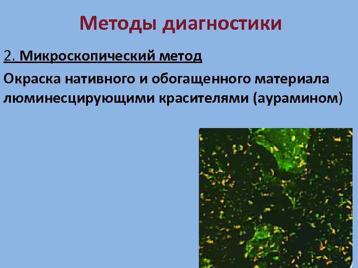 Методы диагностики 2. Микроскопический метод Окраска нативного и обогащенного материала люминесцирующими красителями (аурамином) 