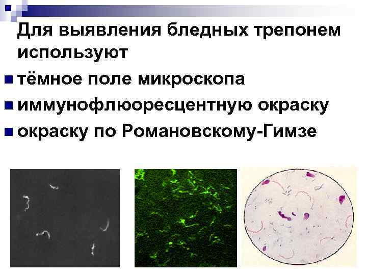 Для выявления бледных трепонем используют n тёмное поле микроскопа n иммунофлюоресцентную окраску n окраску