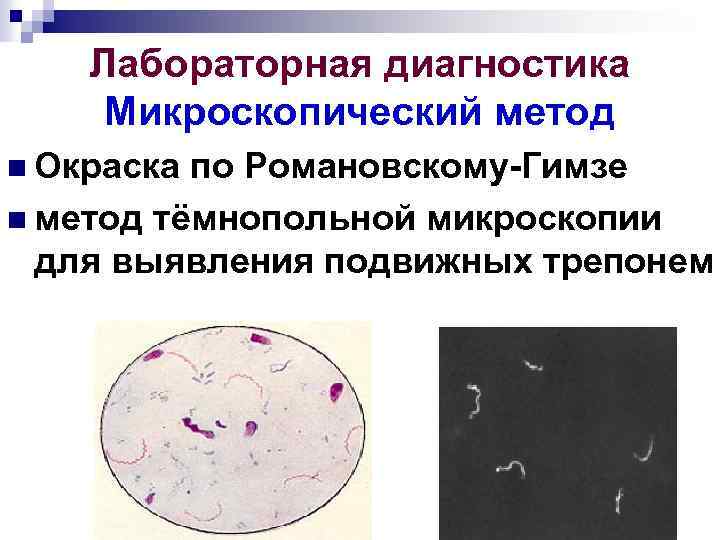 Окраска по романовскому гимзе мазок