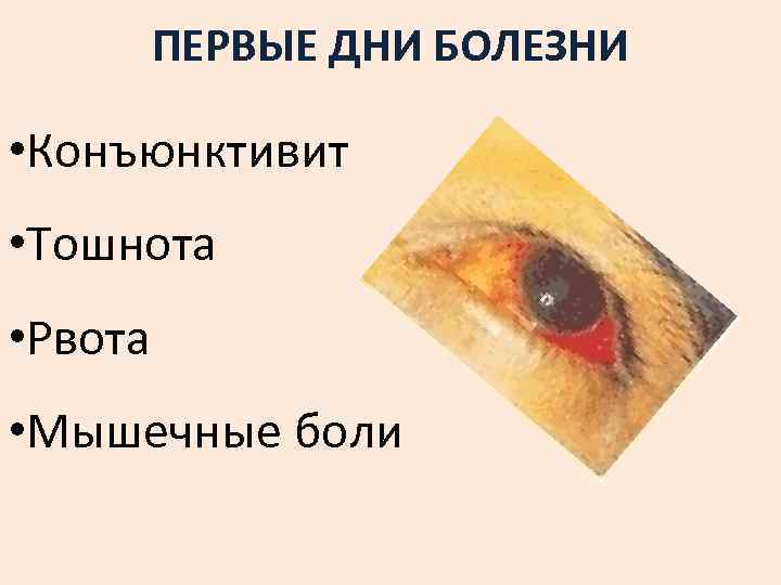 ПЕРВЫЕ ДНИ БОЛЕЗНИ • Конъюнктивит • Тошнота • Рвота • Мышечные боли 