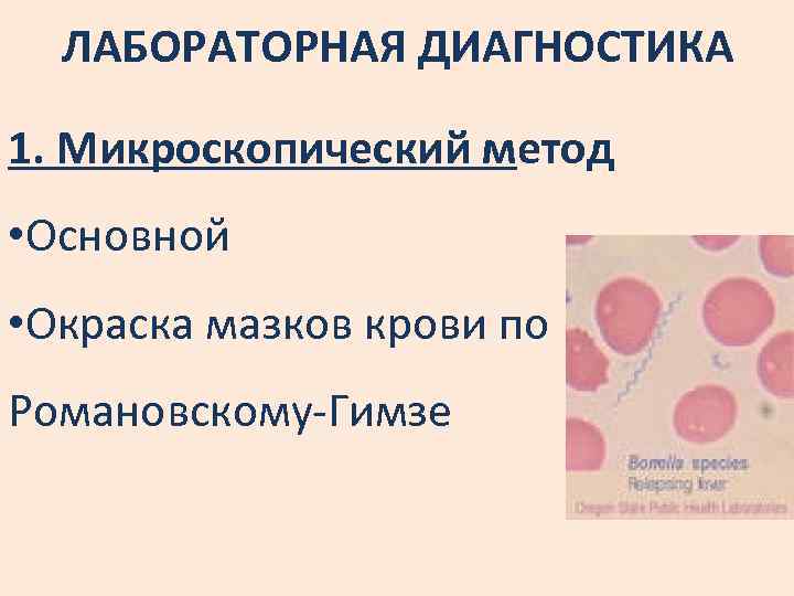 ЛАБОРАТОРНАЯ ДИАГНОСТИКА 1. Микроскопический метод • Основной • Окраска мазков крови по Романовскому-Гимзе 