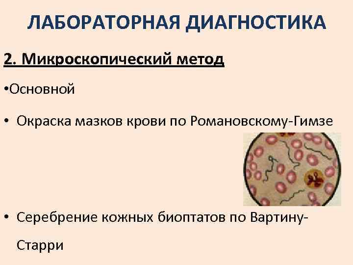ЛАБОРАТОРНАЯ ДИАГНОСТИКА 2. Микроскопический метод • Основной • Окраска мазков крови по Романовскому-Гимзе •
