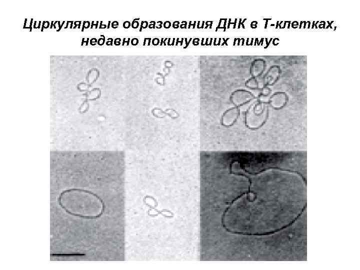 Циркулярные образования ДНК в Т-клетках, недавно покинувших тимус 