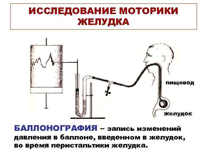 ИССЛЕДОВАНИЕ МОТОРИКИ ЖЕЛУДКА пищевод желудок БАЛЛОНОГРАФИЯ – запись изменений давления в баллоне, введенном в