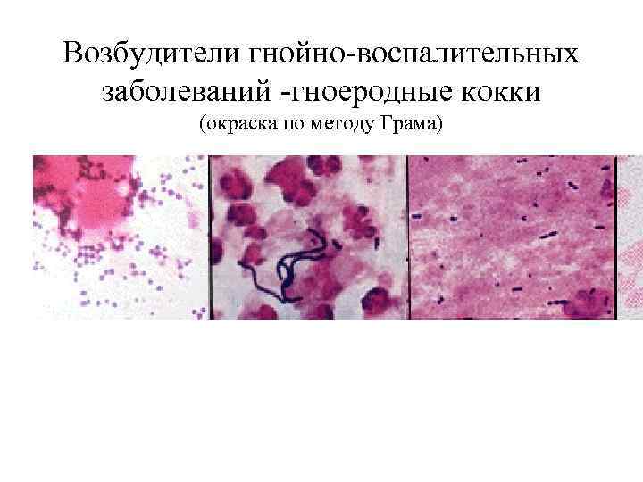 Возбудители гнойно-воспалительных заболеваний -гноеродные кокки (окраска по методу Грама) 