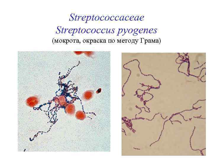 Streptococcaceae Streptococcus pyogenes (мокрота, окраска по методу Грама) 