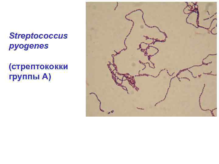 Streptococcus pyogenes (стрептококки группы А) 