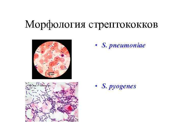 Морфология стрептококков • S. pneumoniae • S. pyogenes 