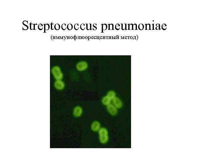 Streptococcus pneumoniae (иммунофлюоресцентный метод) 