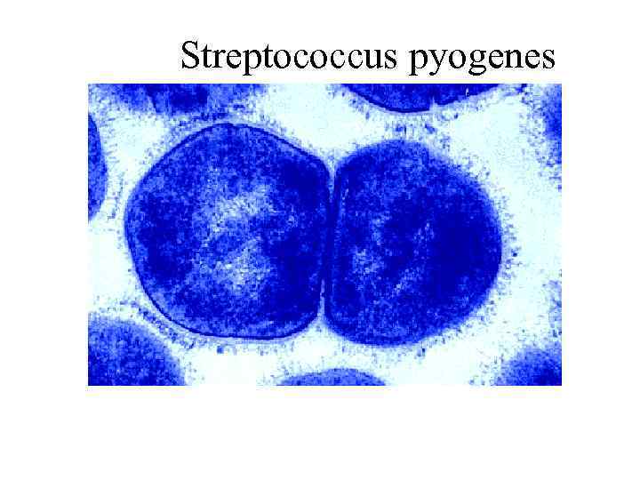 Streptococcus pyogenes 