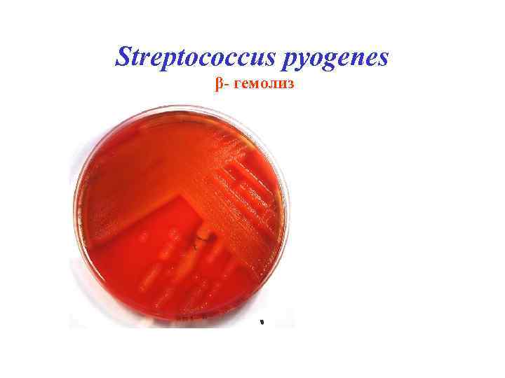 Streptococcus pyogenes β- гемолиз 