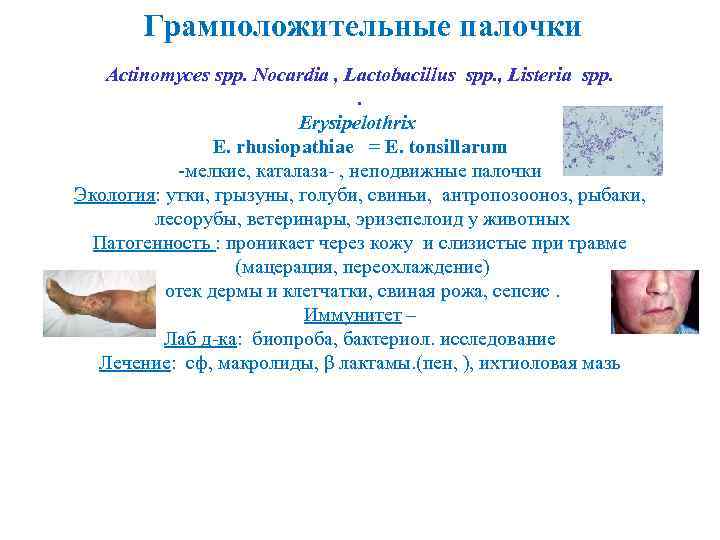 Грамположительные палочки Асtinomyces spp. Nocardia , Lactobacillus spp. , Listeria spp. . Erysipelothrix E.