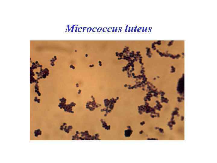 Micrococcus luteus 