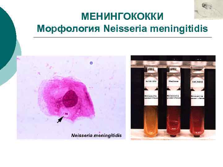 МЕНИНГОКОККИ Морфология Neisseria meningitidis 