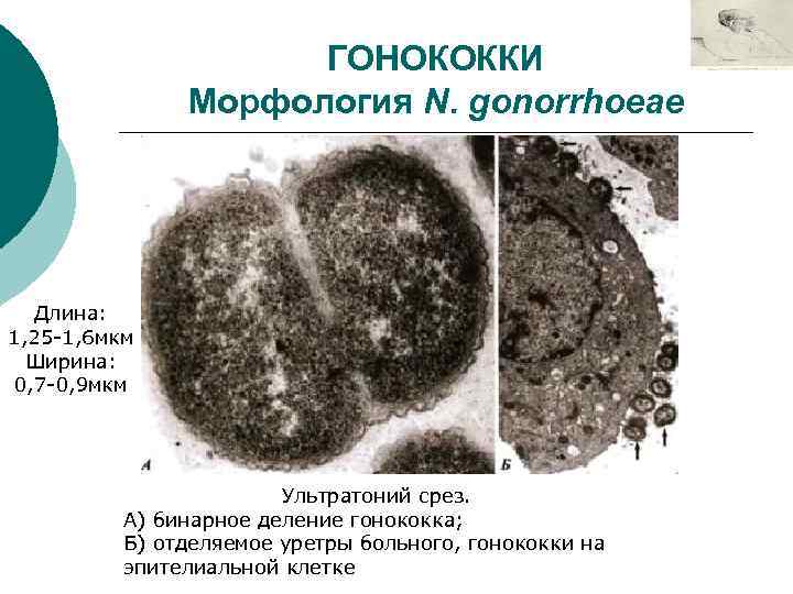 ГОНОКОККИ Морфология N. gonorrhoeae Длина: 1, 25 -1, 6 мкм Ширина: 0, 7 -0,