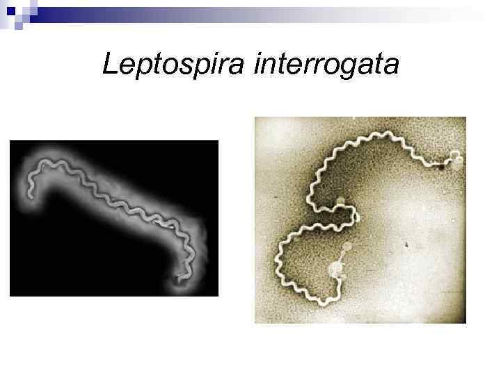 Leptospira interrogata 
