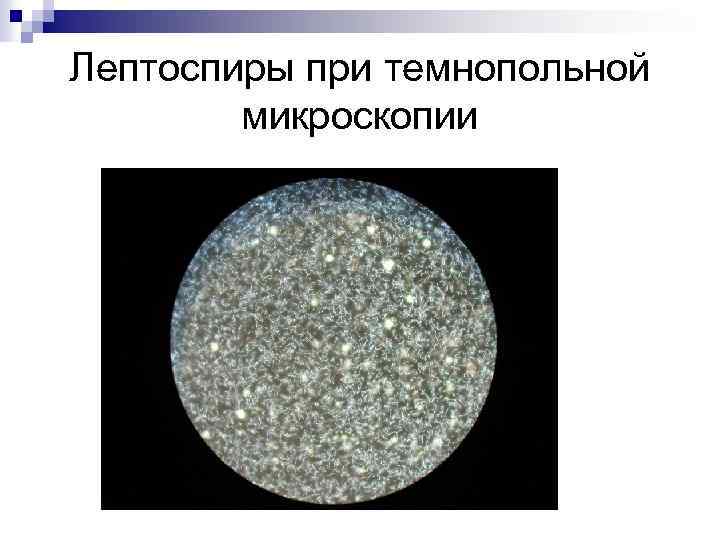 Лептоспиры при темнопольной микроскопии 
