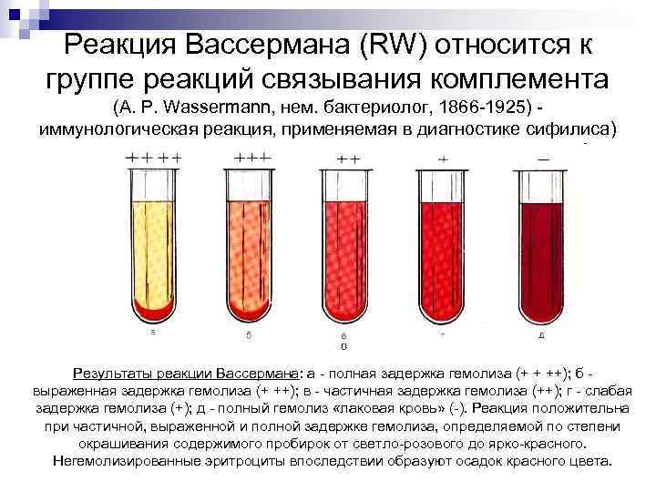 Реакция связывания комплемента микробиология