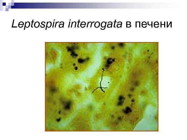 Leptospira interrogata в печени 
