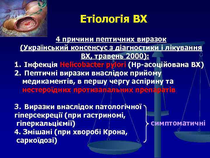 Етіологія ВХ 4 причини пептичних виразок (Український консенсус з діагностики і лікування ВХ, травень