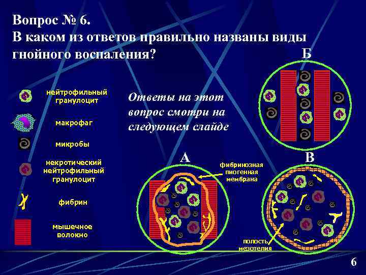 Вопрос № 6. В каком из ответов правильно названы виды Б гнойного воспаления? нейтрофильный