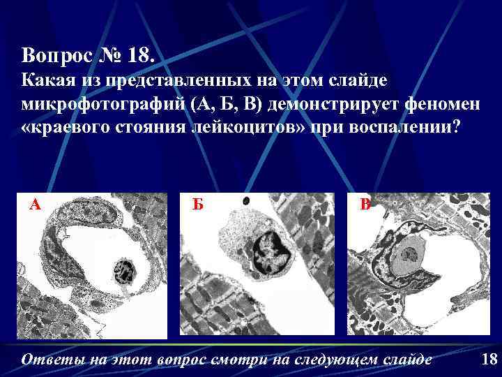 Вопрос № 18. Какая из представленных на этом слайде микрофотографий (А, Б, В) демонстрирует