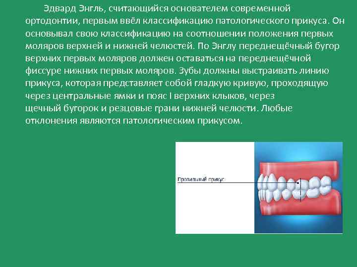 Эдвард Энгль, считающийся основателем современной ортодонтии, первым ввёл классификацию патологического прикуса. Он основывал свою