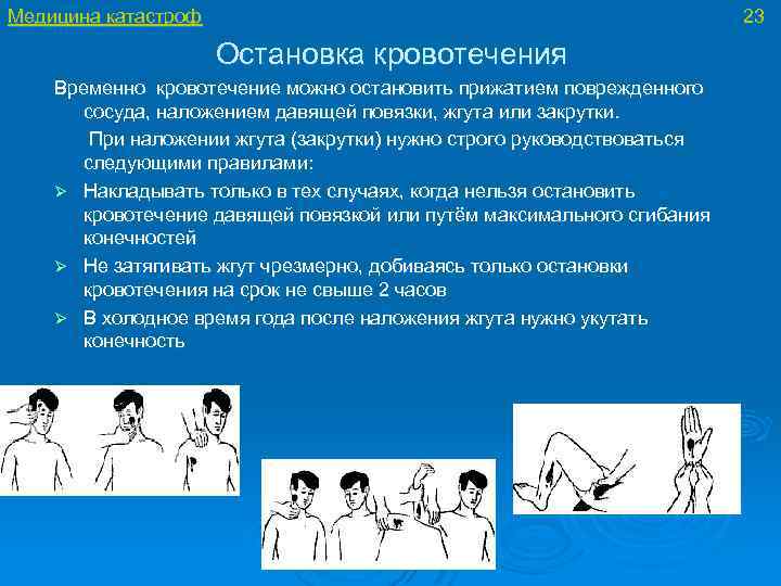 Медицина катастроф 23 Остановка кровотечения Временно кровотечение можно остановить прижатием поврежденного сосуда, наложением давящей