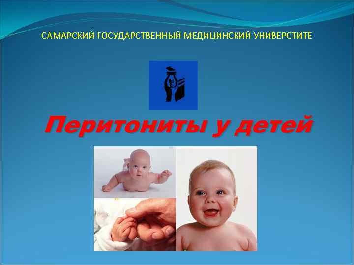 САМАРСКИЙ ГОСУДАРСТВЕННЫЙ МЕДИЦИНСКИЙ УНИВЕРСТИТЕ Перитониты у детей 
