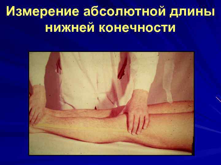 Измерение абсолютной длины нижней конечности 
