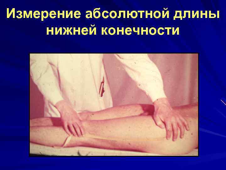 Измерение абсолютной длины нижней конечности 