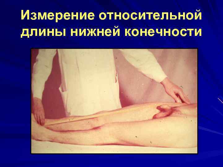 Измерение относительной длины нижней конечности 