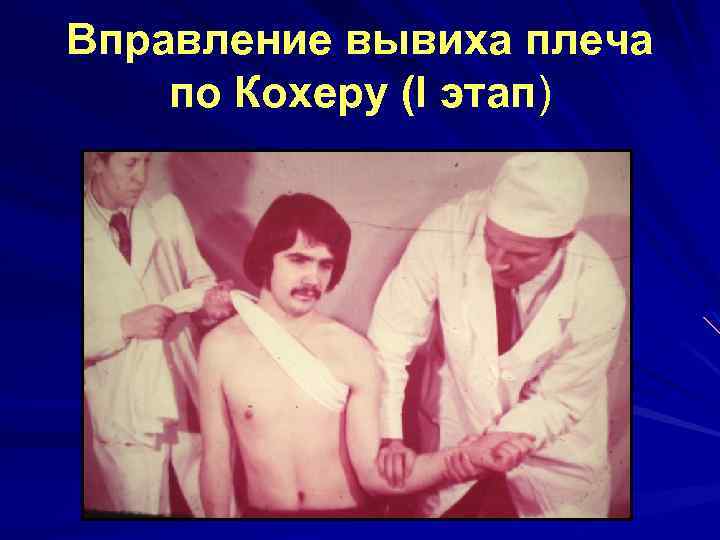 Вправление вывиха плеча по Кохеру (I этап) 