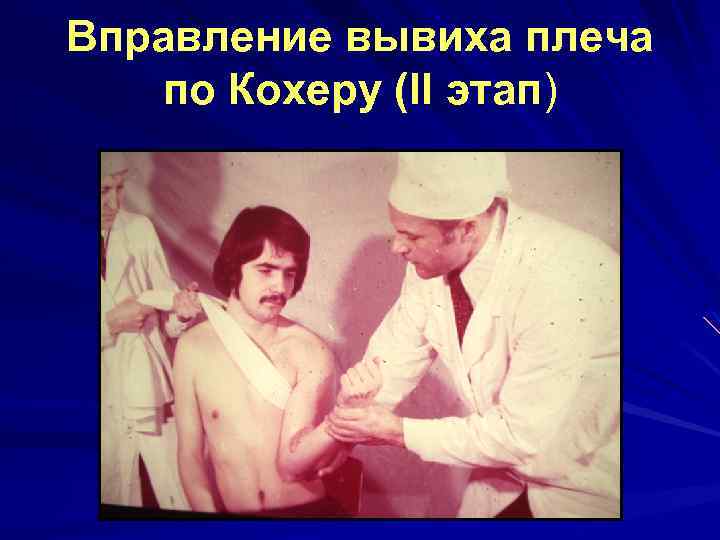 Вправление вывиха плеча по Кохеру (II этап) 