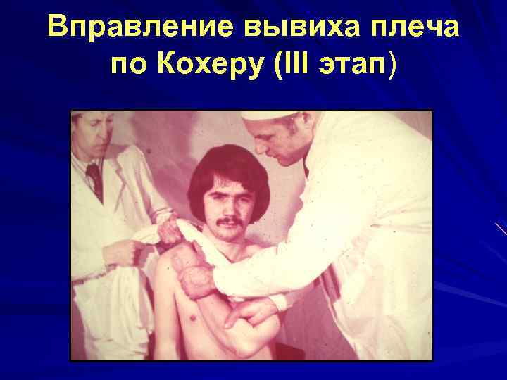 Вправление вывиха плеча по Кохеру (III этап) 