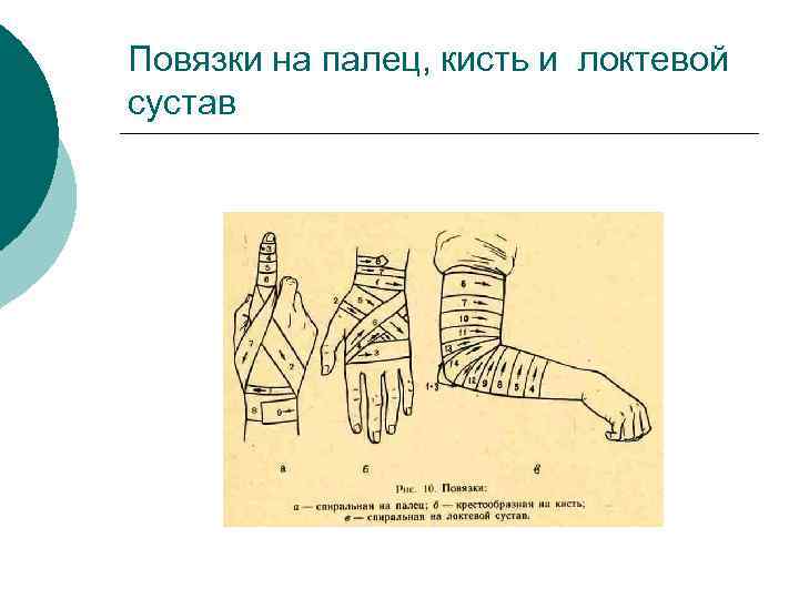 Повязки на палец, кисть и локтевой сустав 