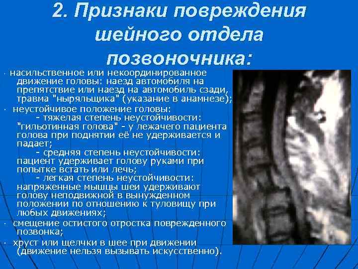 Признаки повреждения. Повреждение шейного отдела позвоночника новорожденного. Травма шейного отдела позвоночника. Шейная травма позвоночника. Признаки повреждения шейного отдела позвоночника.