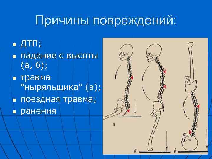 Травмы при падении с высоты презентация