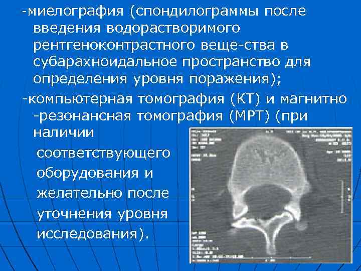 Картина расширения субарахноидальных пространств