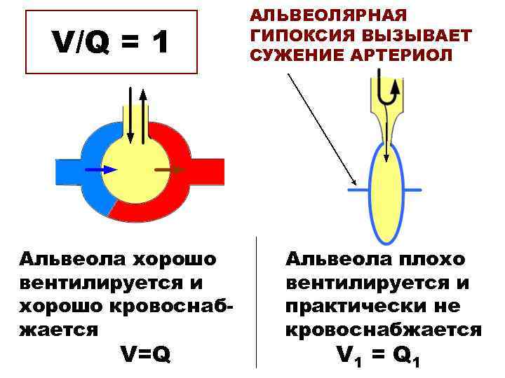 V/Q = 1 Альвеола хорошо вентилируется и хорошо кровоснабжается V=Q АЛЬВЕОЛЯРНАЯ ГИПОКСИЯ ВЫЗЫВАЕТ СУЖЕНИЕ