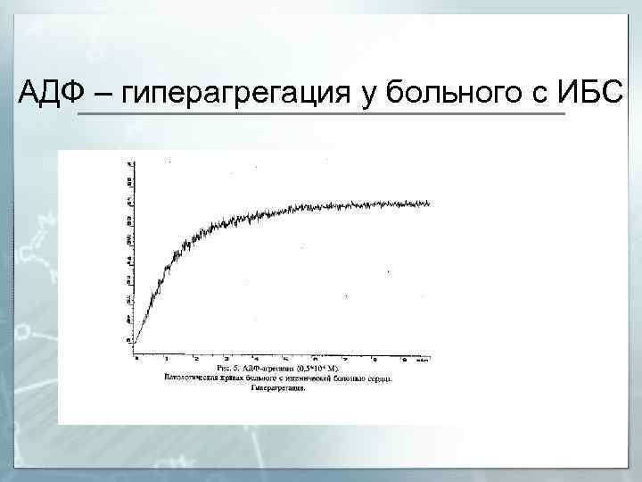 АДФ – гиперагрегация у больного с ИБС 
