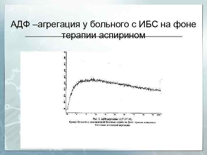 АДФ –агрегация у больного с ИБС на фоне терапии аспирином 