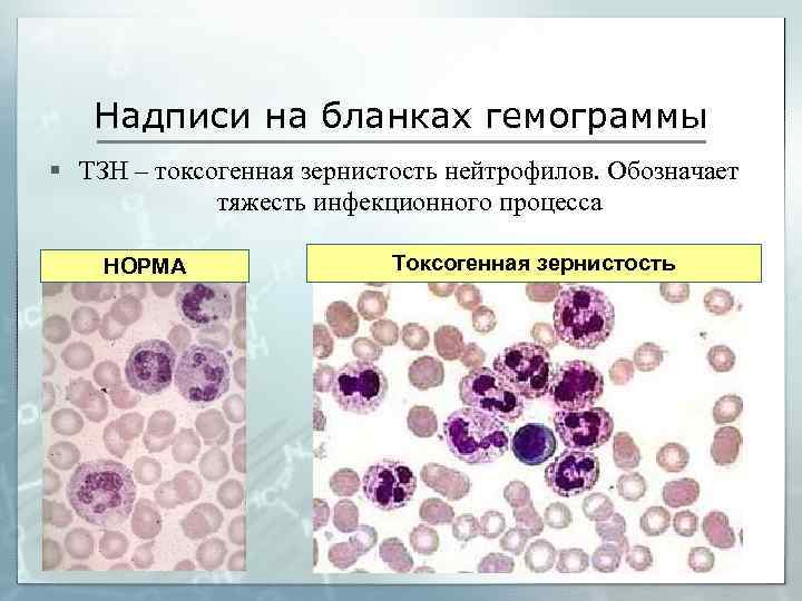 Токсогенная зернистость нейтрофилов. Токсигенная зернистость нейтрофилов. Токсическая (токсогенная) зернистость нейтрофилов. Базофильная зернистость нейтрофилов. Токсогенная зернистость лейкоцитов в общем анализе крови у ребенка.