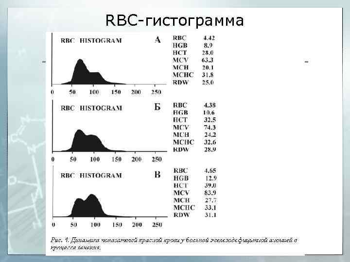 RBC-гистограмма 