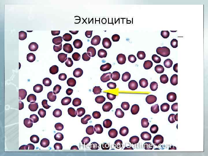Эхиноциты 