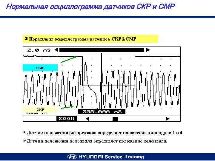 Нормальная осциллограмма датчиков СКР и СМР ▣ Нормальна осциллограмма датчиков CKP&CMP CKP ▷ Датчик